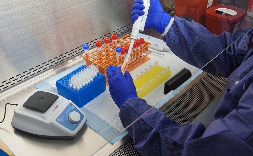 covid-19 laboratorio