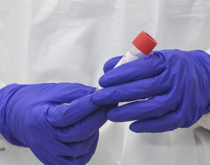 Sette i casi di Omicron in Sicilia