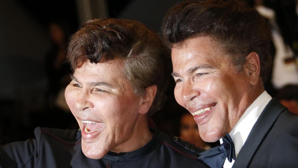 I gemelli Bogdanoff, morti di Covid-19.