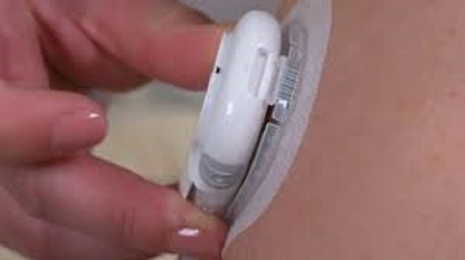 La bimba diabetica ha ricevuto la fornitura necessaria attesa da mesi per rimettere in funzione il microinfusore che inietta l’insulina