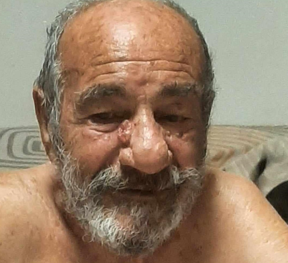 Un anziano non da sue notizie da 2 giorni, scomparso dopo essere uscito di casa per andare a raccogliere lumache