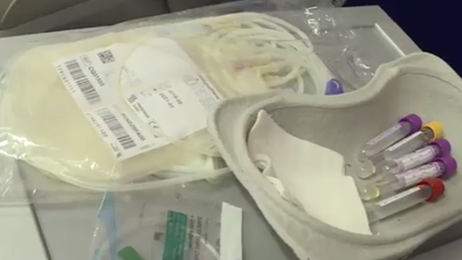 Si registra una forte carenza di sacche di sangue negli ospedali Cervello e Civico di Palermo, l’aiuto anche da altre regioni