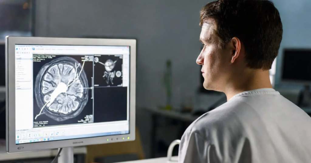 Sclerosi multipla e bavisant.