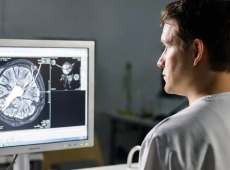 Sclerosi multipla, perché la ricerca sul bavisant sta facendo parlare il mondo scientifico