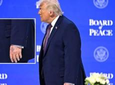 Quel livido sulla mano di Trump che ha fatto il giro del mondo