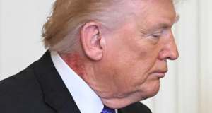 Trump con un segno rosso sul collo, le spiegazioni del medico della Casa Bianca