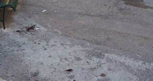 Aggredito a calci e pugni dopo un rimprovero da un gruppo di ragazzi in zona Oreto